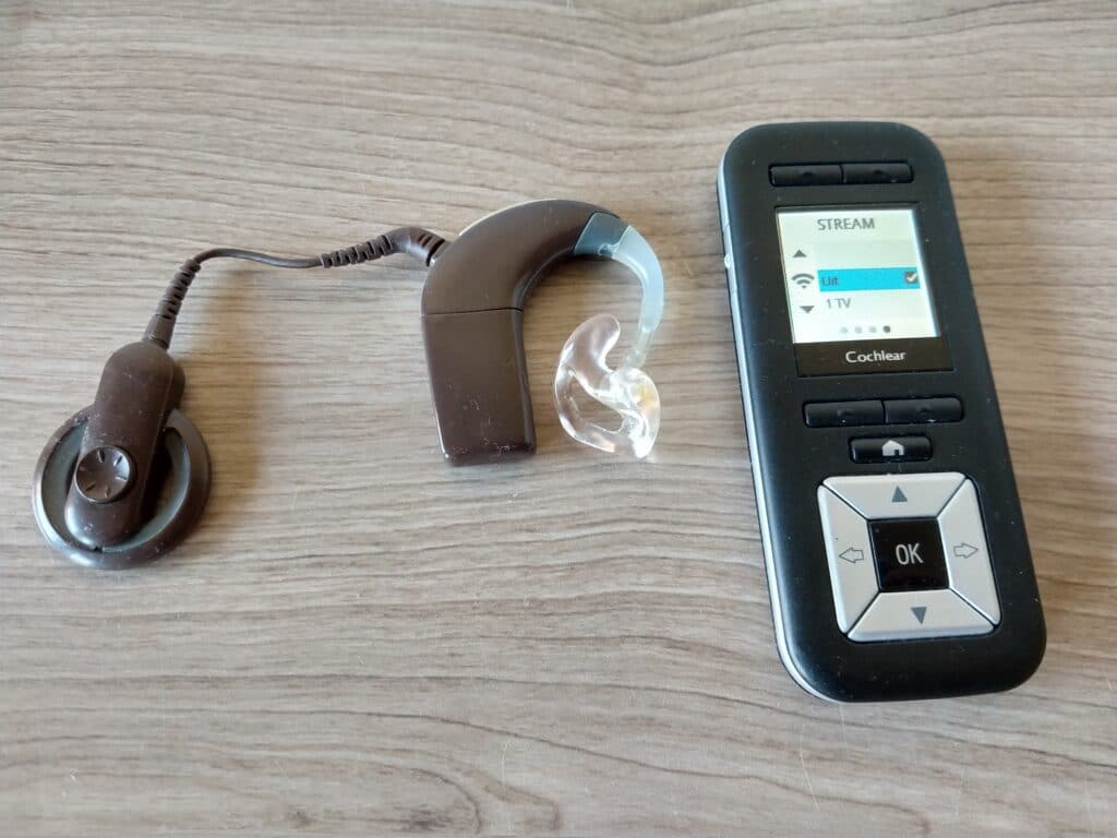 cochleair implantaat